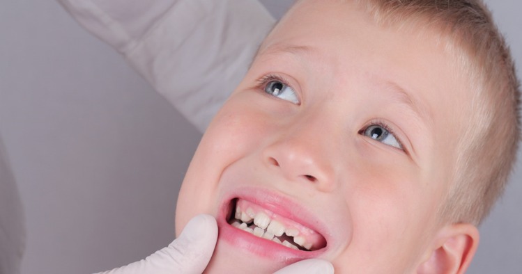 Gap Between Front Teeth डायस्टेमा एक स्वाभाविक प्रक्रिया
